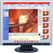 供应杰软胸腔镜影像系统工作站